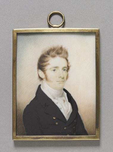 Portrait of a Man with a Cleft Lip