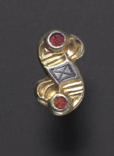 S-Shaped Fibula