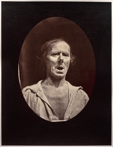 Figure 54: Abaissement volontaire de la mâchoire inférieure: mouvement inexpressif