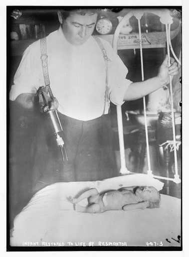 Infant restored to life by [Poe] respirator