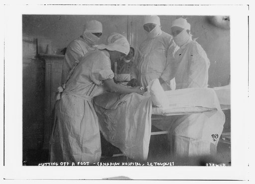 Cutting off a foot -- Canadian Hospital, Le Touquet