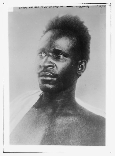 Wounded "French" prisoner of Germans