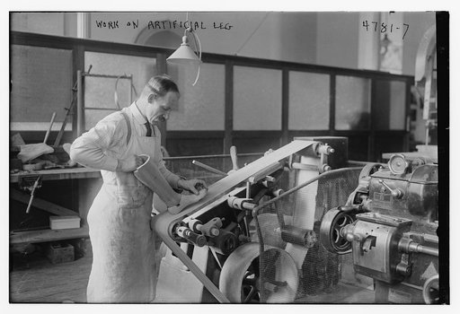 Work on artificial leg