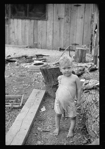 Sharecropper's child suffering from rickets and malnutrition, Wilson cotton plantation, Mississippi County, Arkansas