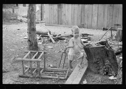 Untitled photo, possibly related to: Sharecropper's child suffering from rickets and malnutrition, Wilson cotton plantation, Mississippi County, Arkansas