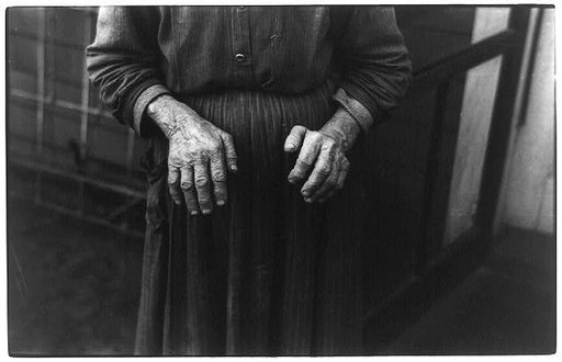 The hands of Mrs. Andrew Ostermeyer, wife of a homesteader, Woodbury County, Iowa