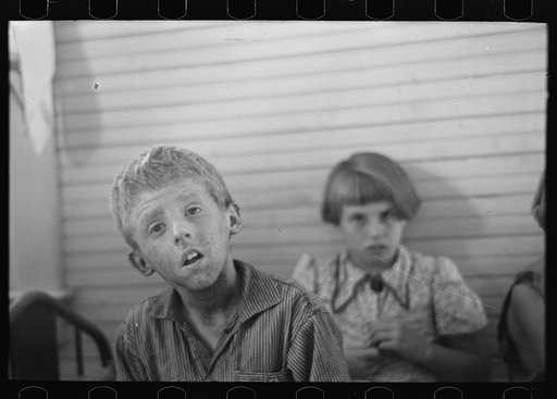 Son of Olaf Fugelburg, farmer of Williams County, North Dakota. He has had weeping eczema since birth