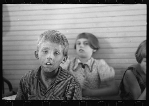 Untitled photo, possibly related to: Son of Olaf Fugelburg, farmer of Williams County, North Dakota. He has had weeping eczema since birth