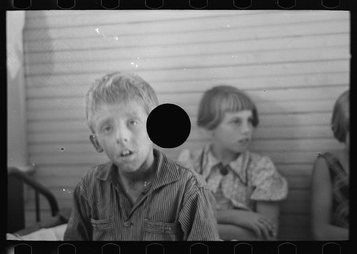 Untitled photo, possibly related to: Son of Olaf Fugelburg, farmer of Williams County, North Dakota. He has had weeping eczema since birth