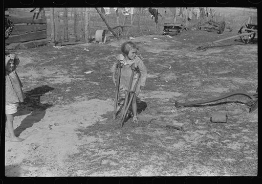 Ten year old child of George Cowley Family (rural rehabilitation client). Her bones break exceptionally easy (diet deficiency said to be one of causes) and one leg has been broken five times and doesn't mend properly. Pike County, Alabama