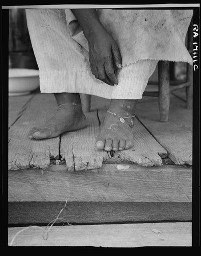 Fifty-seven year old sharecropper woman. Hinds County, Mississippi. Thin dimes around the ankles to prevent headaches