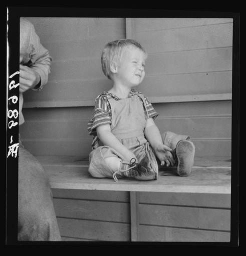 Tulare County, California. In Farm Security Administration (FSA) camp for migratory workers. Baby with club feet wearing homemade splints inside shoes
