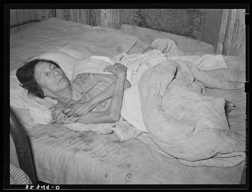 Mexican woman with advanced case of arthritis. Crystal City, Texas. She has been confined to her bed for several years