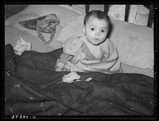 Mexican child in bed. The baby has impetigo. Crystal City, Texas