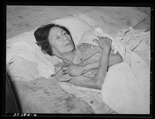 Mexican woman with advanced case of arthritis. She has been confined to bed for several years. Crystal City, Texas