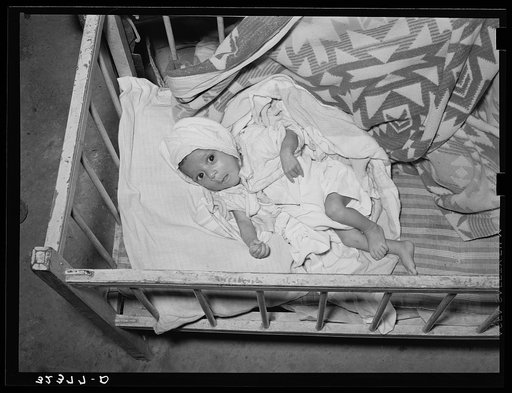 Mexican baby. This child is suffering from malnutrition. Notice the legs and arms. Crystal City, Texas