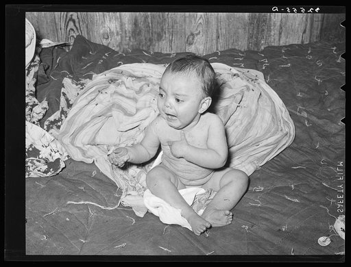 Mexican baby with impetigo. Crystal City, Texas