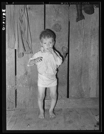 Child with rickets, son of relief client near Jefferson, Texas. This child has never talked though he is two years old. He has never received any medical attention