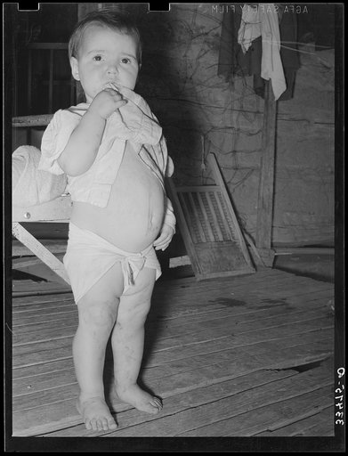 Child of tenant farmer. Notice distended stomach, indicative of malnutrition. Near Warner, Oklahoma