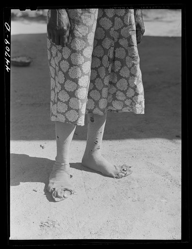 Feet of a Negro farm woman, who together with two children runs a rented farm. Near Woodville, Greene County Georgia