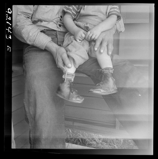 Untitled photo, possibly related to: Tulare County. In Farm Security Administration (FSA) camp for migratory workers. Baby with club feet wearing homemade splints inside shoes