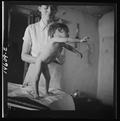 Penasco, New Mexico. Five-year-old child, stunted by malnutrition, being examined at the clinic operated by the Taos County cooperative health association