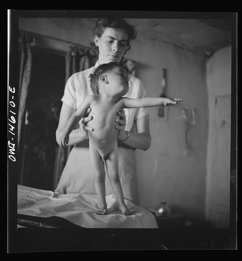 Penasco, New Mexico. Five-year-old child, stunted by malnutrition, being examined at the clinic operated by the Taos County cooperative health association