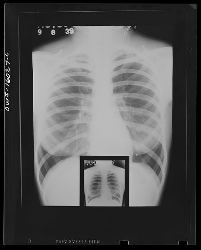 Untitled photo, possibly related to: Detroit, Michigan. New method of making x-ray photographs size 4x5 inches instead of larger. Used at the Herman Kiefer Hospital for Communicable Diseases to show various stages of tuberculosis