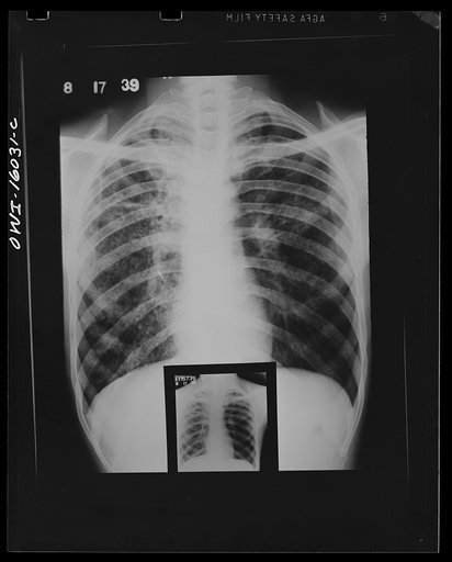 Untitled photo, possibly related to: Detroit, Michigan. New method of making x-ray photographs size 4x5 inches instead of larger. Used at the Herman Kiefer Hospital for Communicable Diseases to show various stages of tuberculosis