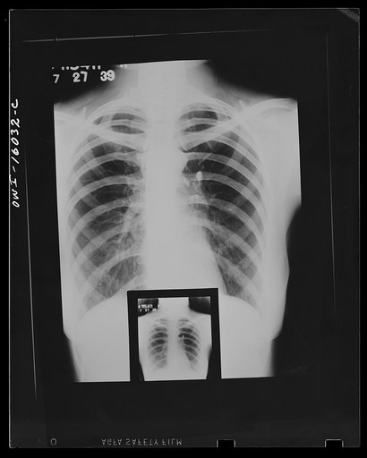 Untitled photo, possibly related to: Detroit, Michigan. New method of making x-ray photographs size 4x5 inches instead of larger. Used at the Herman Kiefer Hospital for Communicable Diseases to show various stages of tuberculosis