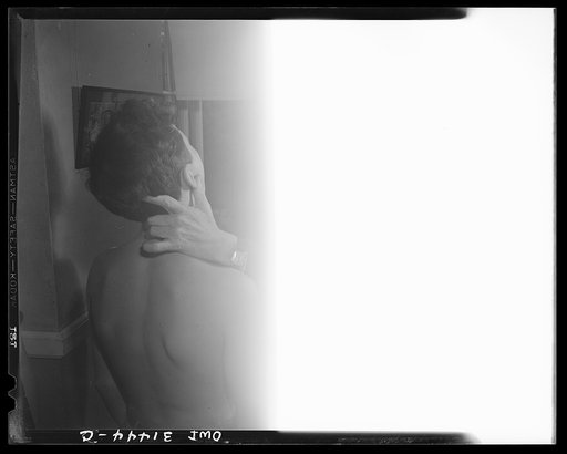 Untitled photo, possibly related to: Schenectady, New York. This boy, a pupil at the Elmer Avenue Elementary School, has been taking exercise in corrective classes. He is being checked up to see how his back is progressing