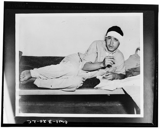 Smoking an American cigarette, this Jap prisoner from the Solomon Islands shows concern as his picture is taken in a clearing station in New Caledonia