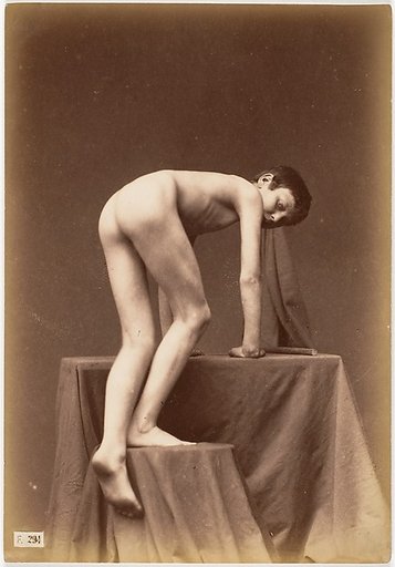 [Young Boy, Nude, From the Back, Climbing]