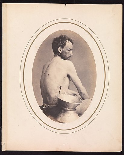 Corporal Israel Spotts, Company G, 200th Pennsylvania Volunteers