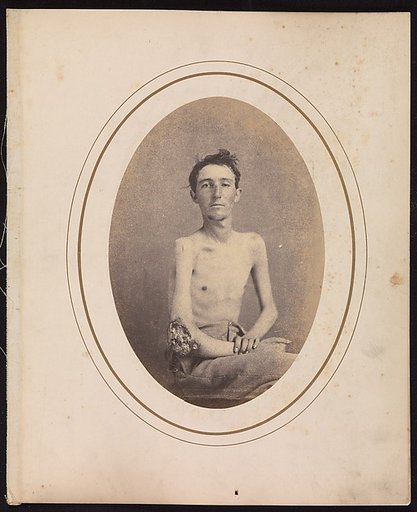 Private James H. Stokes, Company H, 185th New York Volunteers