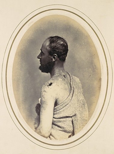 Henry Yon