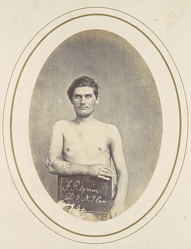 Frederick Pilgrim