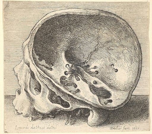 Sectioned skull in profile to left with the left side of the cranium removed