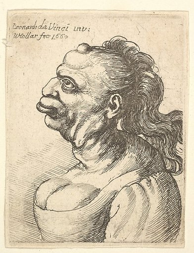 Bust of a woman wearing low-cut dress, with protruding lipd, growth on her forehead, prominent breast,  long flowing hair down her back, in profile to left.