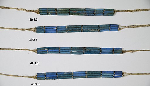 Anklet of Wah