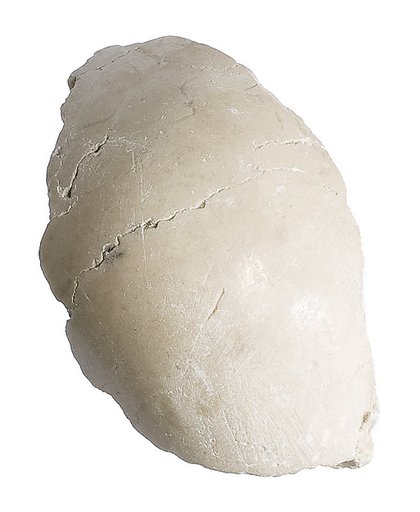 Elbow or shoulder