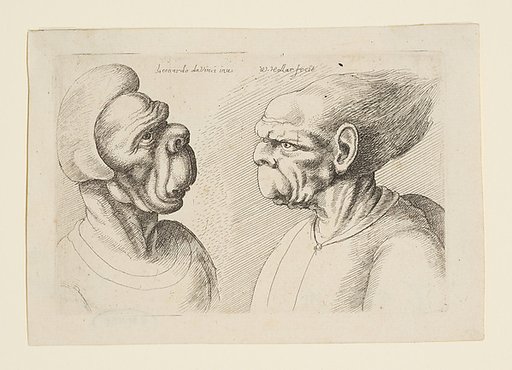 Two Deformed Heads with Very Long Upper Lips