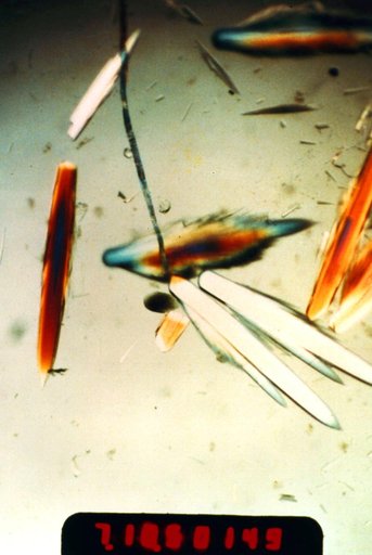 Microgravity