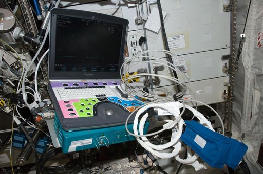 ICV Echo Ultrasound Scan