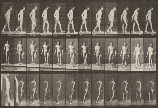 Plate Number 559. Partial paraplegia, walking with cane