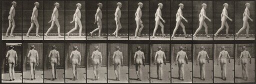 Plate Number 562. Lateral curvature of spine, walking