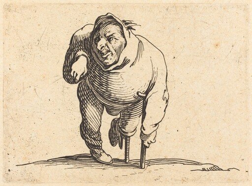 Cripple with Crutch and Wooden Leg