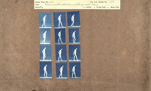 Disseminated sclerosis, walking with cane