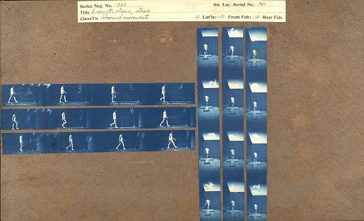 Locomotor, ataxia; ataxia