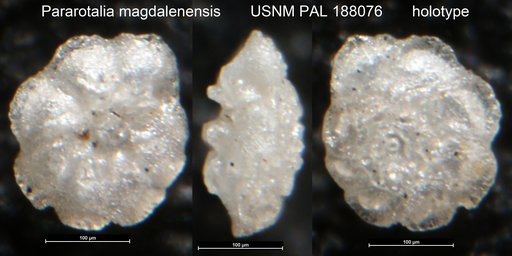 Pararotalia magdalenensis Lankford, 1973